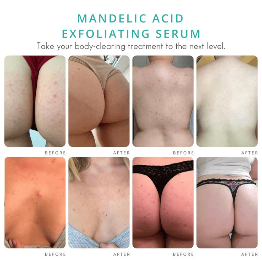 SUERO LIMPIADOR CORPORAL, 1 Oz - Imagen 3