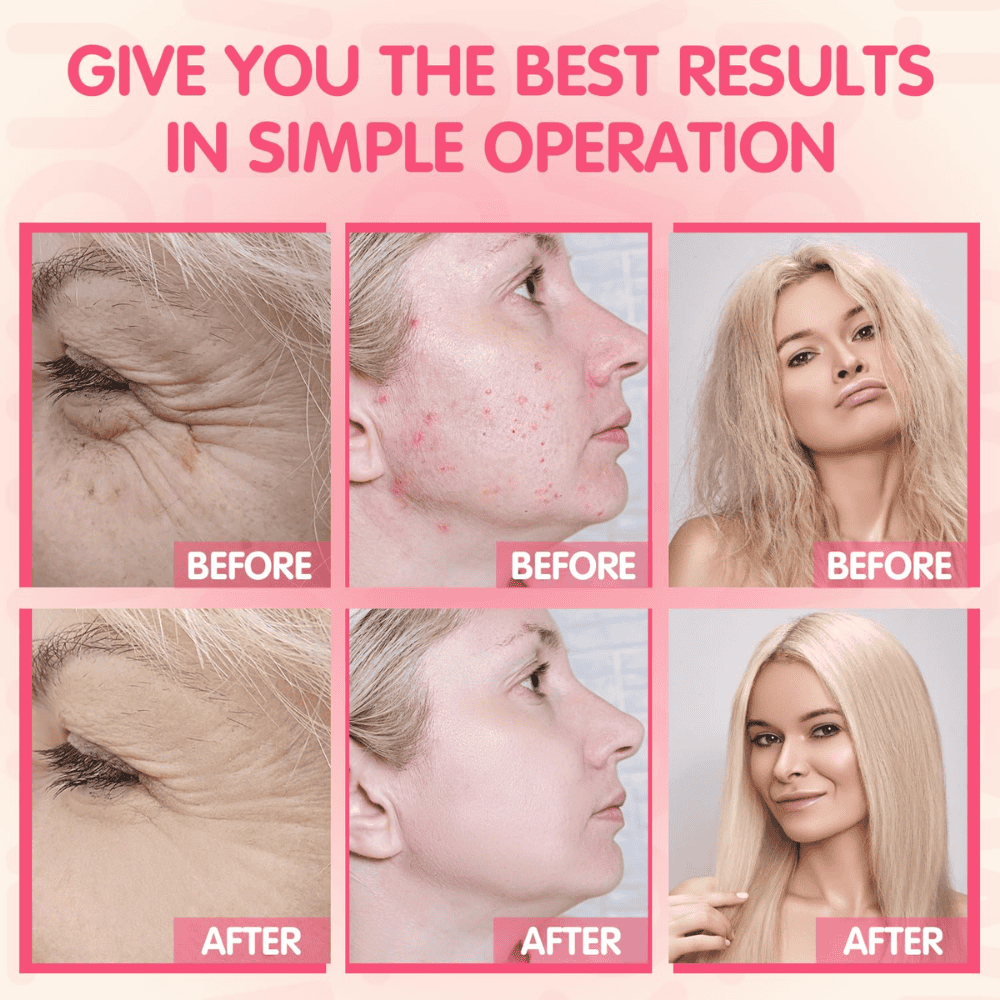 ALTA FRECUENCIA PROFESIONAL DISPOSITIVO LUMINA NEON Pro - Imagen 5